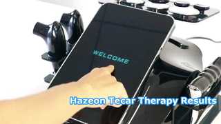 Machine de thérapie Hazeon Tecar RL-W20 – Appareil avancé de physiothérapie et de rééducation 448 kHz