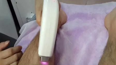 Machine d'épilation au laser à diode 808nm à prix compétitif avec énergie de 1 à 50A et largeur d'impulsion de 1 à 400ms pour une utilisation en salon